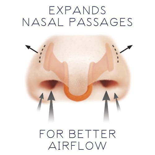 Nasal Dilator Nose Orange Dilator Arrows Airmax &Lt;H1&Gt;Airmax Nasal Dilator (Small + Medium)&Lt;/H1&Gt; Https://Www.youtube.com/Watch?V=2W8Igra27O0 &Lt;P Data-Reactid=&Quot;362&Quot;&Gt;Airmax Nasal Dilator Will Improve Your Nasal Airflow Significantly And Help You Breath Better, The Airmax Is A Well-Developed Product In The Field Of Nasal Dilators. The Shape Of The Airmax Has Been Developed By Airflow Experts And Its Positive Effects Have Been Tested And Proven By Ent Doctors. Airmax Nasal Dilator Has Successfully Been Used In Multiple Clinical Studies Over The Last Years.&Lt;/P&Gt; Airmax Nasal Airmax Nasal Dilator – Small+Medium